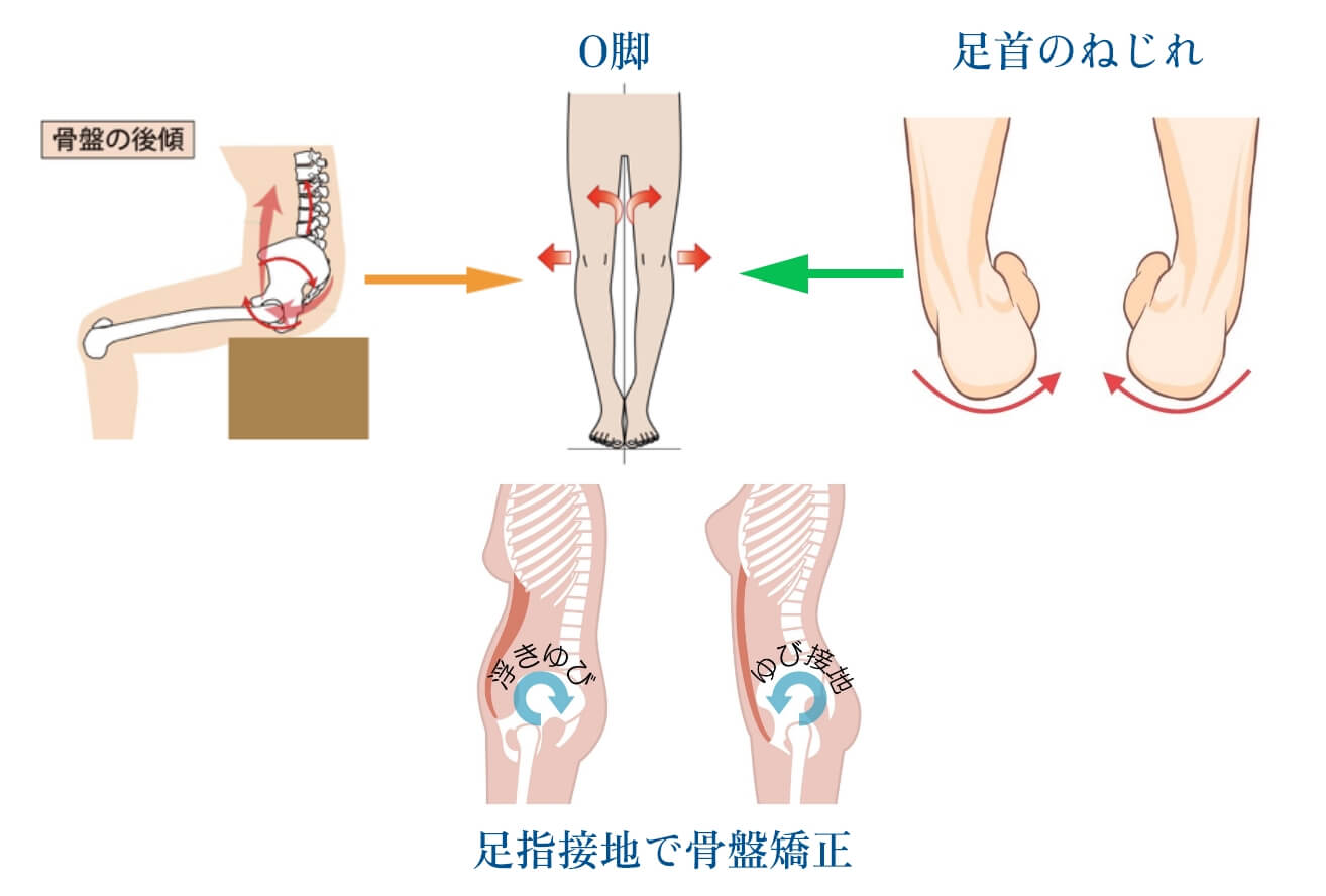 骨盤の後傾と足首のねじれでO客になる