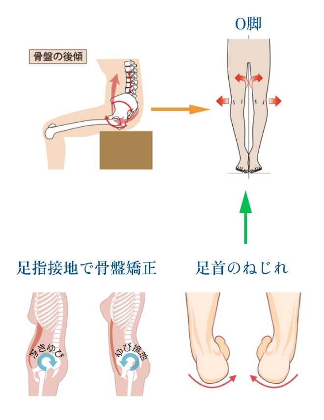 骨盤の後傾と足首のねじれでO客になる